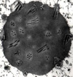 A black and white electron microscope image of a baculovirus